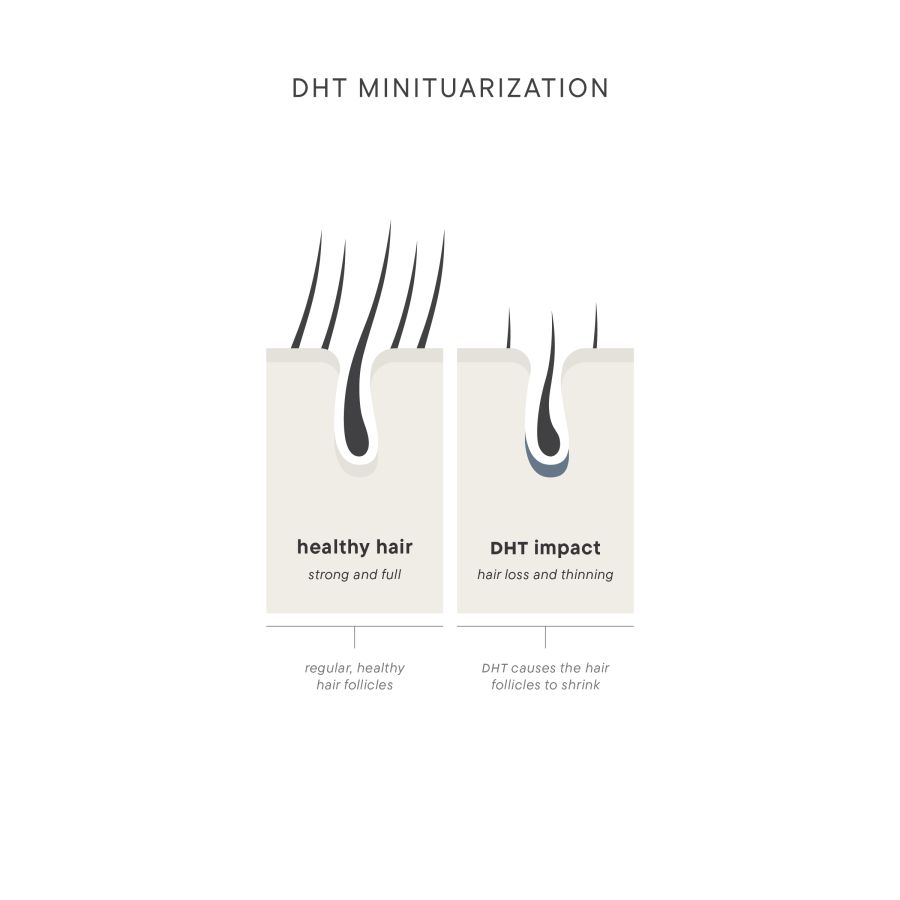 DHT%20Infographic%20ScalpTherapy%20%20For%20Him-11616119 Folix Hair Restoration - J.Bentley Hair Studio Day Spa | Powell, OH