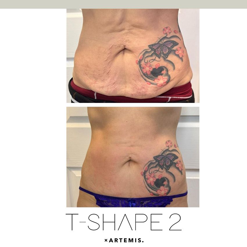 tshape-ba4-965ae05d T-Shape - J.Bentley Hair Studio Day Spa | Powell, OH