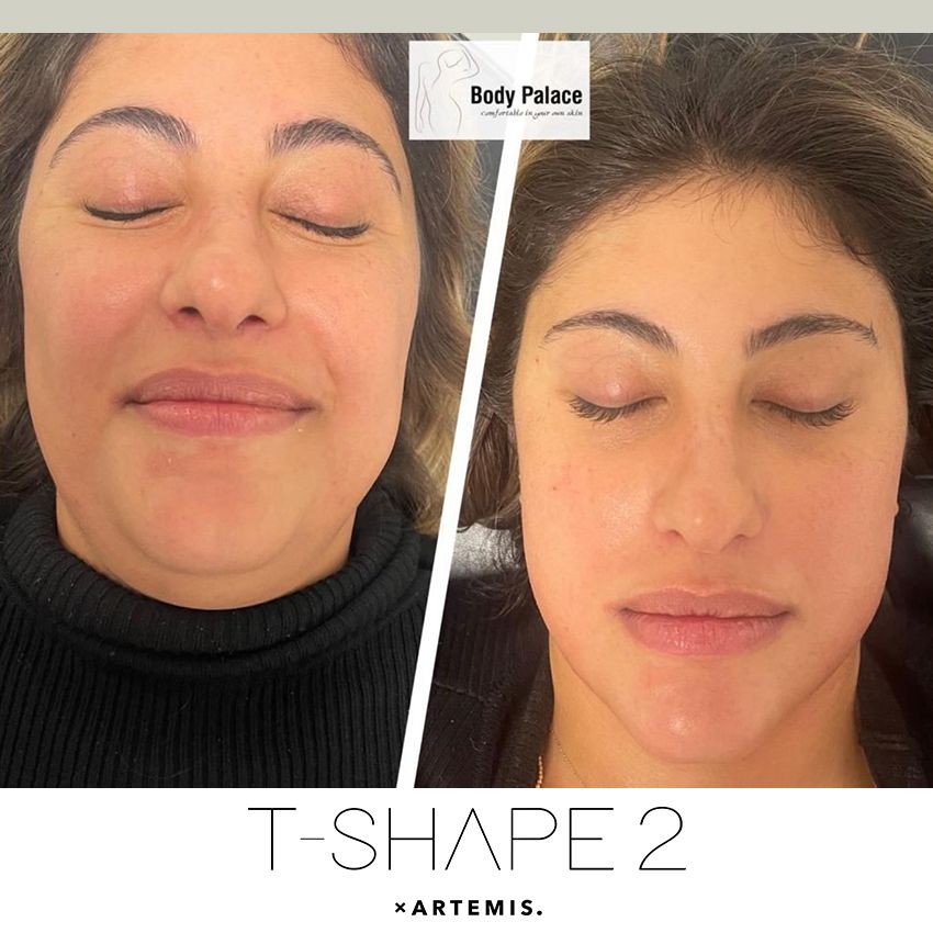 tshape-ba3-c1a970e1 T-Shape - J.Bentley Hair Studio Day Spa | Powell, OH