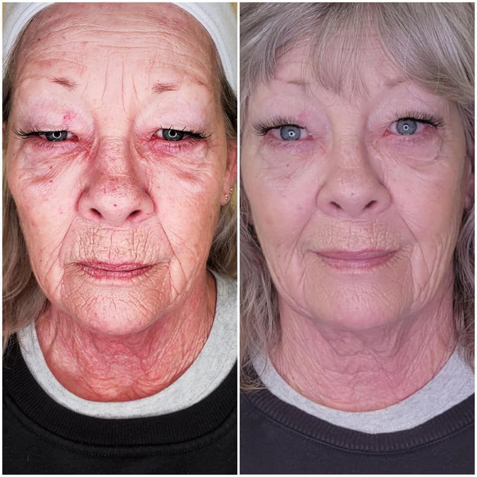 67e6a9d5b55041eff40a9f29_67da38769b55c3446f7cef8e_6-weeks-after-6th-cryofacial-d80fd626 Body Sculpting - J.Bentley Hair Studio Day Spa | Powell, OH