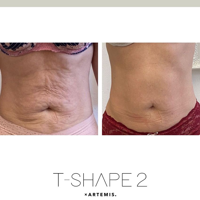 tshape-ba5-e5caf9c6 T-Shape - J.Bentley Hair Studio Day Spa | Powell, OH